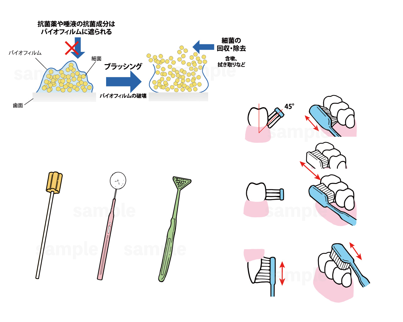 ナース専科 口腔ケアに関する記事の挿絵 Asterisk Discovery